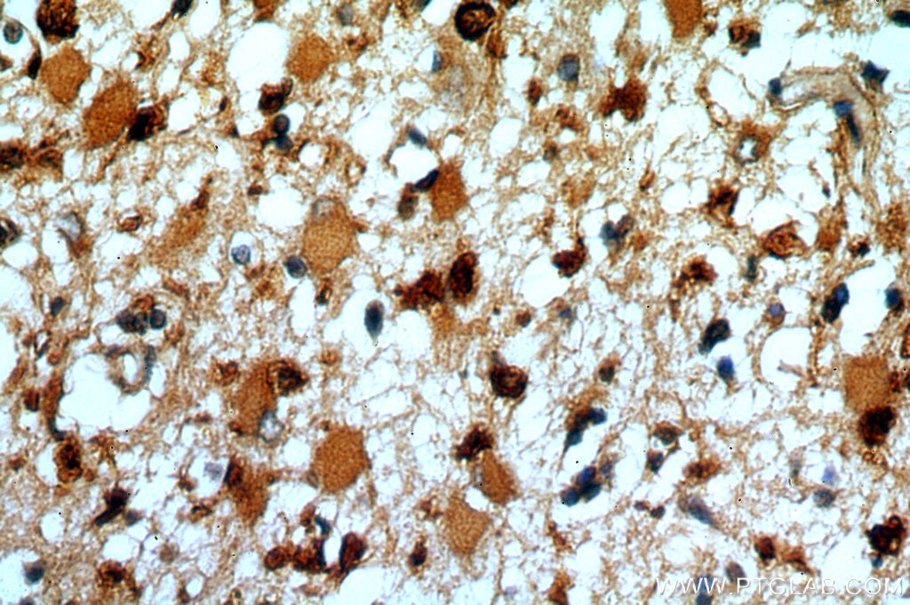 Immunohistochemistry (IHC) staining of human brain tissue using SYT17 Polyclonal antibody (15413-1-AP)