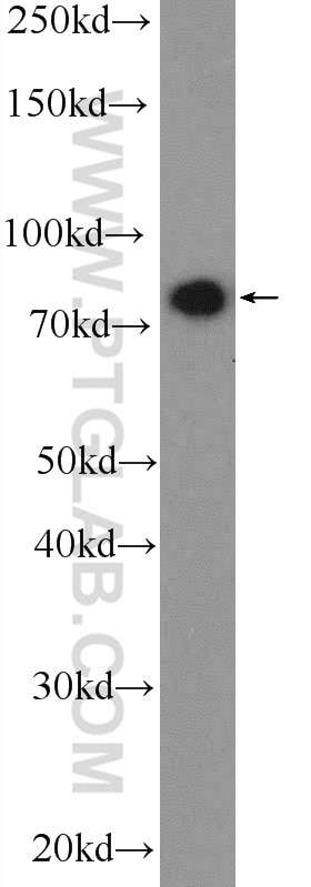 Western Blot (WB) analysis of A375 cells using SYT17 Polyclonal antibody (15413-1-AP)