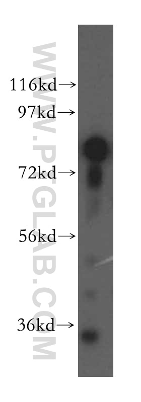 Western Blot (WB) analysis of human brain tissue using SYT17 Polyclonal antibody (15413-1-AP)