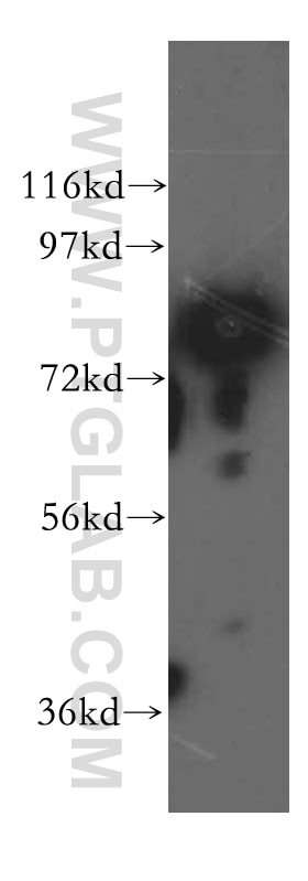 Western Blot (WB) analysis of A375 cells using SYT17 Polyclonal antibody (15413-1-AP)