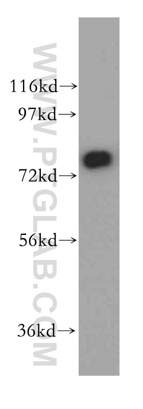 Western Blot (WB) analysis of human kidney tissue using SYT17 Polyclonal antibody (15413-1-AP)