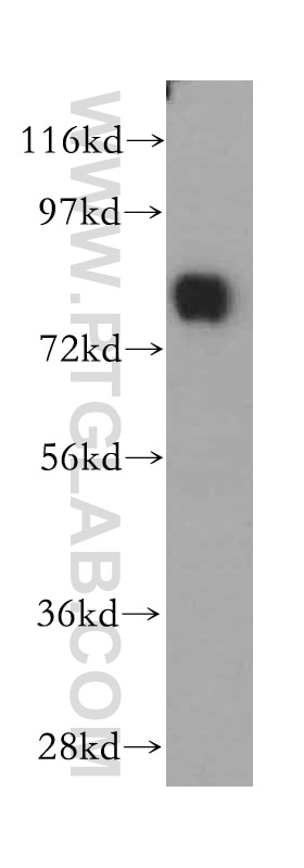Western Blot (WB) analysis of human testis tissue using SYT17 Polyclonal antibody (15413-1-AP)