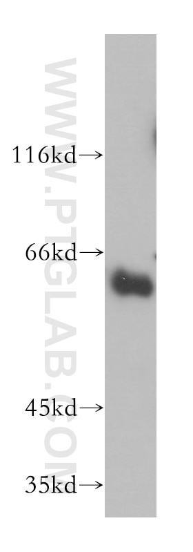 Western Blot (WB) analysis of mouse thymus tissue using Synaptotagmin-3 Polyclonal antibody (12726-1-AP)