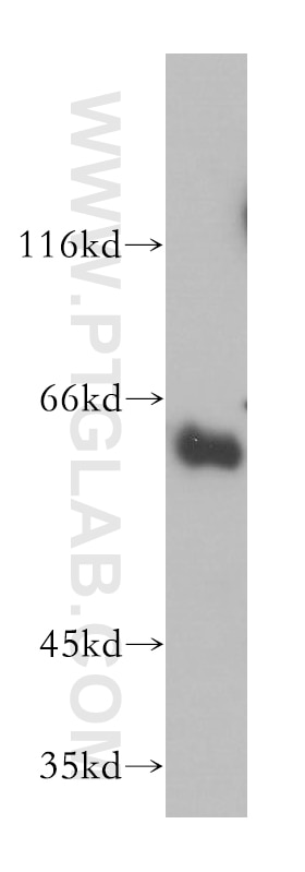 WB analysis of mouse thymus using 12726-1-AP