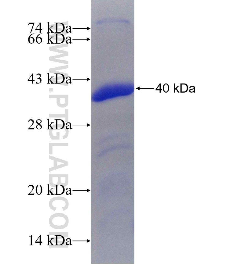 SYT3 fusion protein Ag30027 SDS-PAGE