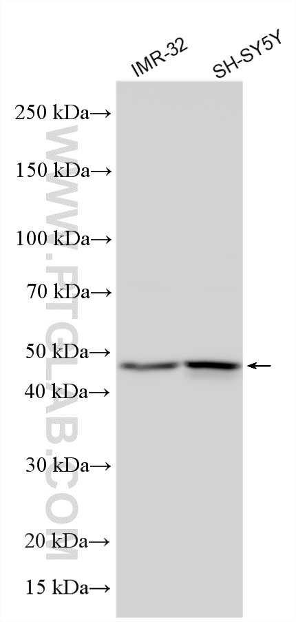 Various lysates were subjected to SDS PAGE followed by western blot with 12642-1-AP (Synaptotagmin-4 antibody) at dilution of 1:2000 incubated at room temperature for 1.5 hours. Western Blot (WB) analysis of various lysates using Synaptotagmin-4 Polyclonal antibody (12642-1-AP)