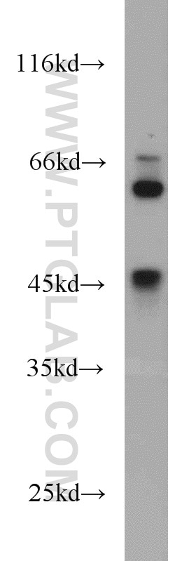 Western Blot (WB) analysis of human brain tissue using Synaptotagmin-4 Polyclonal antibody (12642-1-AP)