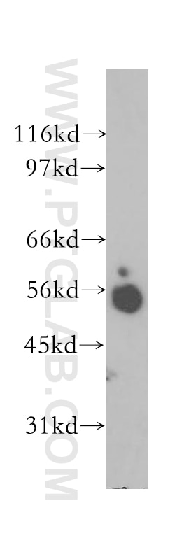 Western Blot (WB) analysis of human brain tissue using Synaptotagmin-4 Polyclonal antibody (12642-1-AP)