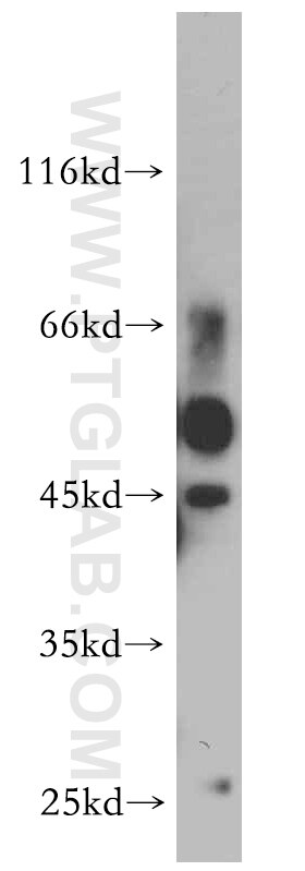 Western Blot (WB) analysis of mouse brain tissue using Synaptotagmin-4 Polyclonal antibody (20472-1-AP)