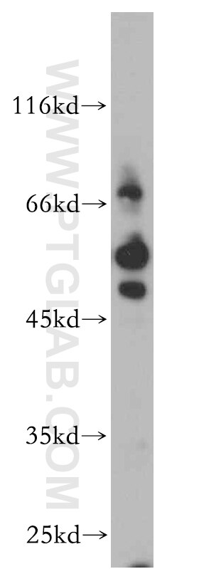 Western Blot (WB) analysis of A431 cells using Synaptotagmin-4 Polyclonal antibody (20472-1-AP)