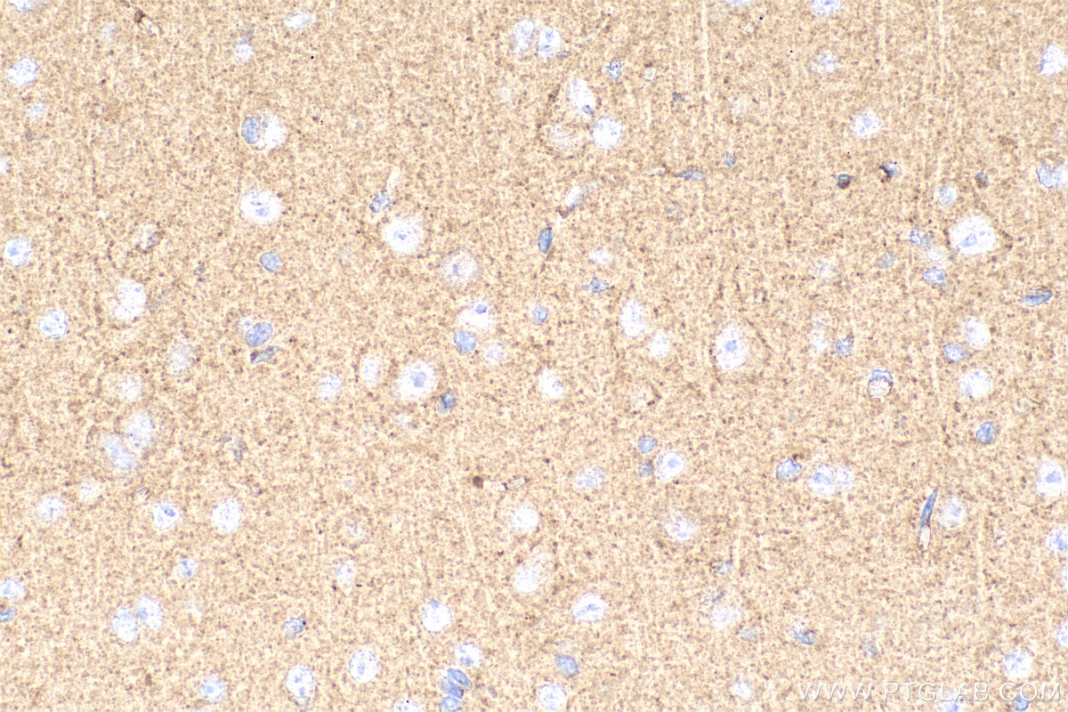 Immunohistochemistry (IHC) staining of mouse brain tissue using Synaptotagmin-5 Polyclonal antibody (18124-1-AP)