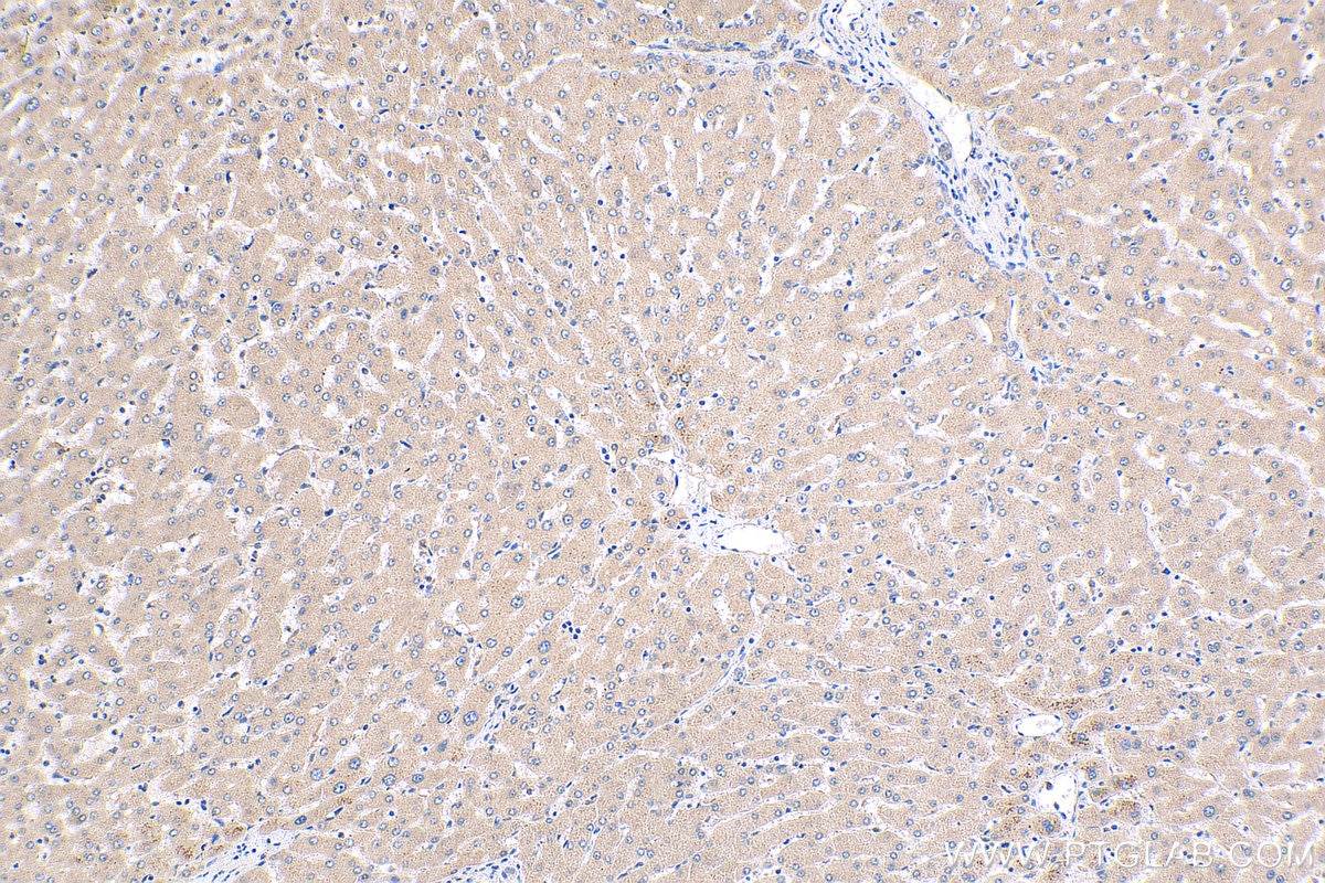 Immunohistochemistry (IHC) staining of human liver tissue using SYT6 Polyclonal antibody (17488-1-AP)