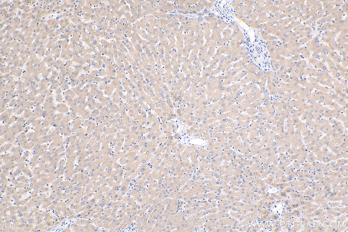 Immunohistochemistry (IHC) staining of human liver tissue using Synaptotagmin-6 Polyclonal antibody (17488-1-AP)