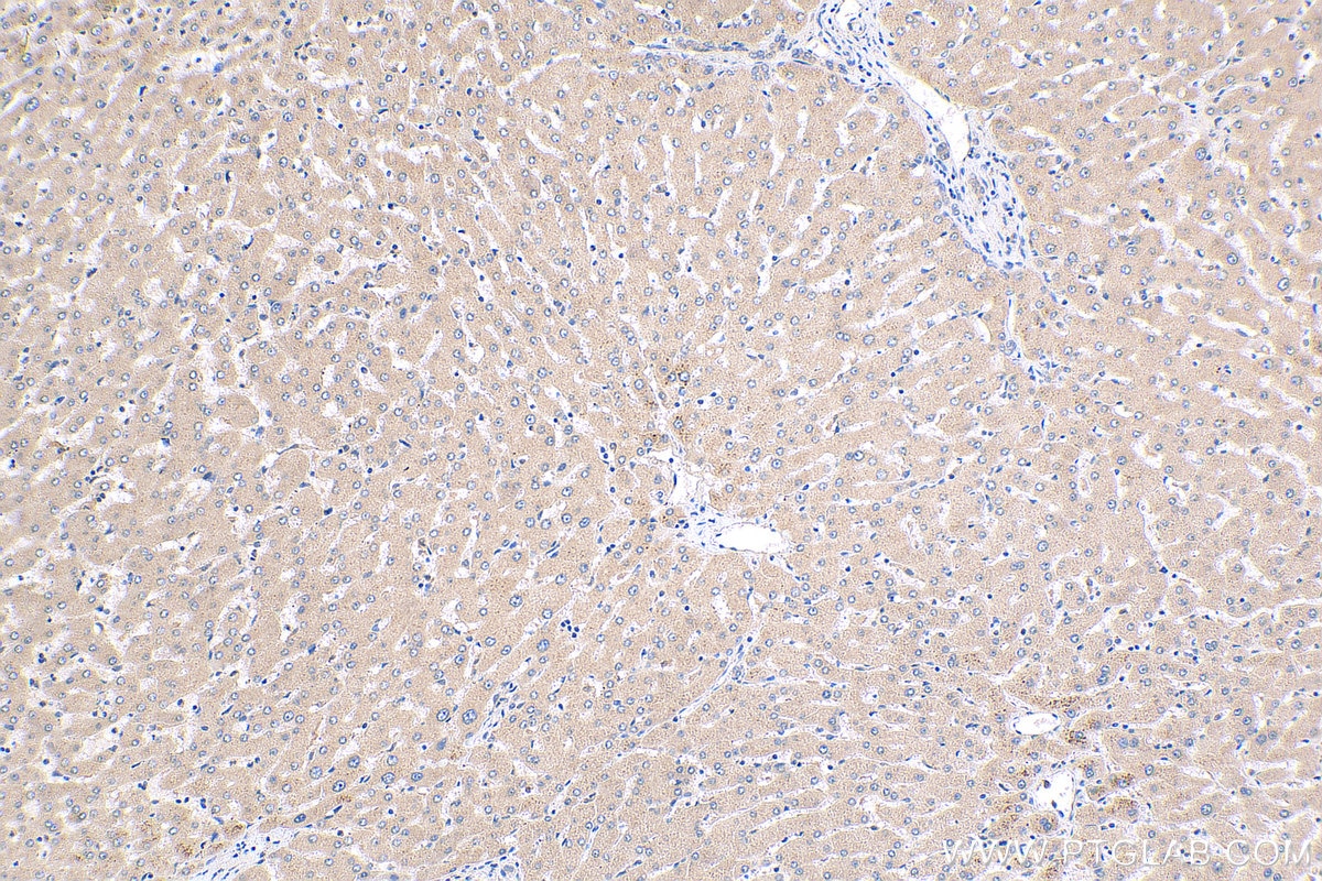 IHC staining of human liver using 17488-1-AP