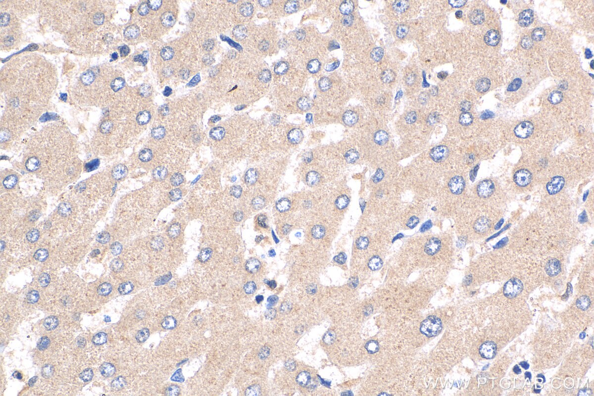 IHC staining of human liver using 17488-1-AP