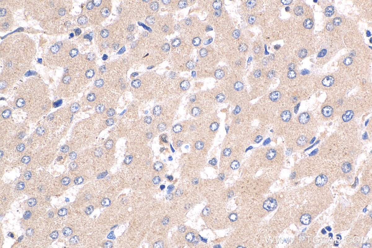 Immunohistochemistry (IHC) staining of human liver tissue using SYT6 Polyclonal antibody (17488-1-AP)