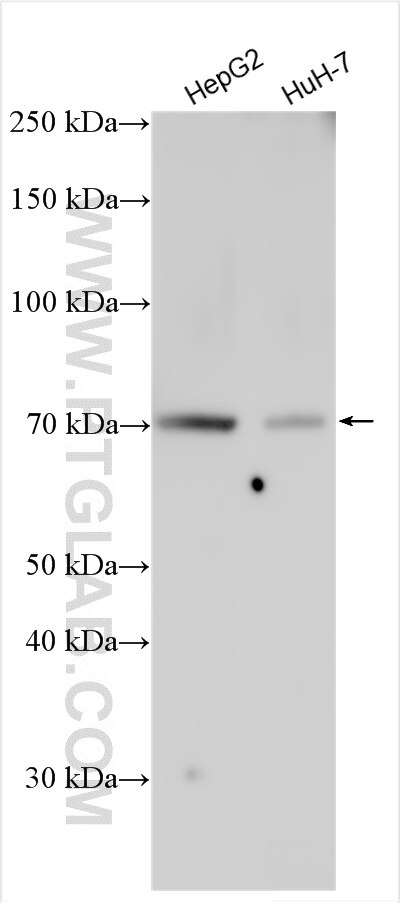 Western Blot (WB) analysis of various lysates using SYT6 Polyclonal antibody (17488-1-AP)
