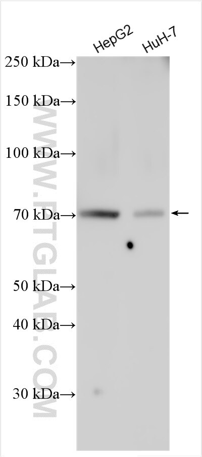 Western Blot (WB) analysis of various lysates using Synaptotagmin-6 Polyclonal antibody (17488-1-AP)