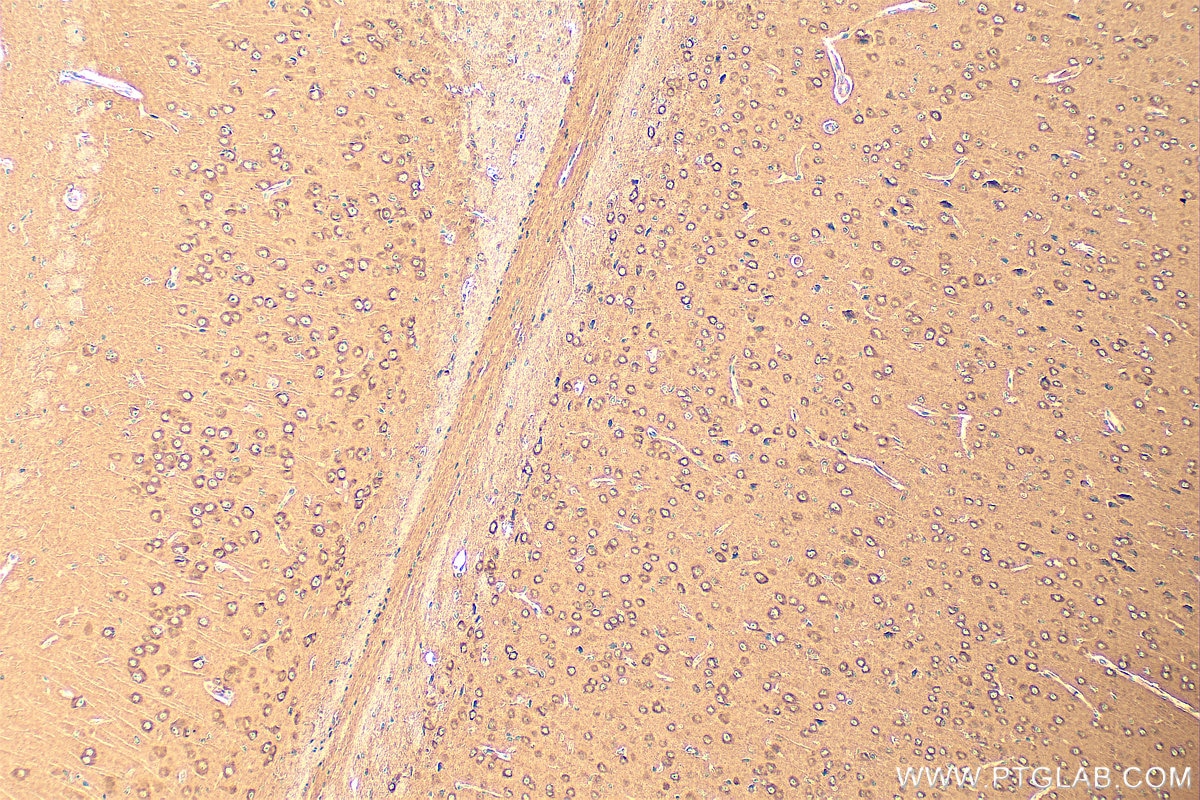 Immunohistochemistry (IHC) staining of mouse brain tissue using SYT7 Polyclonal antibody (19741-1-AP)