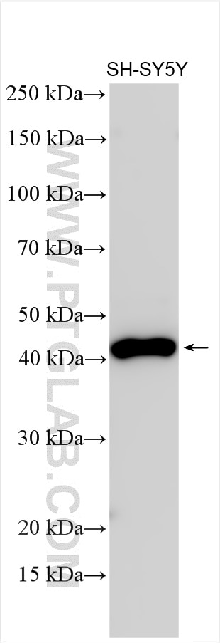 Western Blot (WB) analysis of various lysates using SYT7 Polyclonal antibody (19741-1-AP)