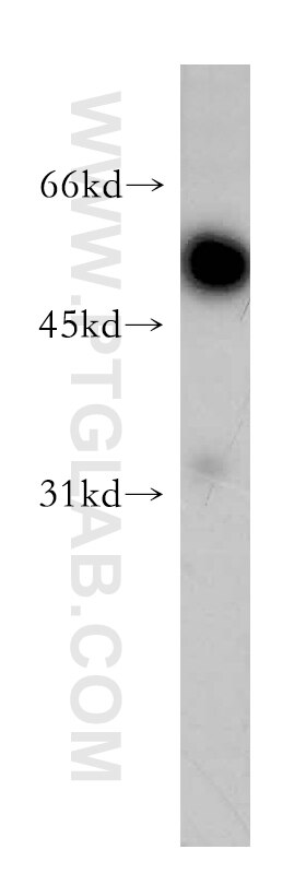 Western Blot (WB) analysis of human brain tissue using Synaptotagmin-9 Polyclonal antibody (12793-1-AP)