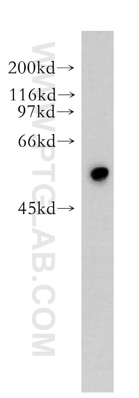 Western Blot (WB) analysis of mouse eye tissue using Synaptotagmin-9 Polyclonal antibody (12793-1-AP)