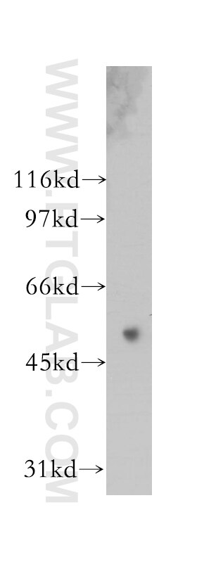 Western Blot (WB) analysis of human kidney tissue using Synaptotagmin-9 Polyclonal antibody (12793-1-AP)