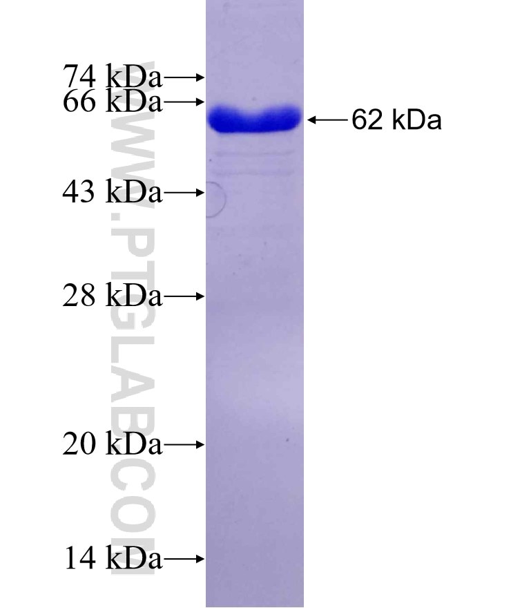 SYT9 fusion protein Ag3520 SDS-PAGE