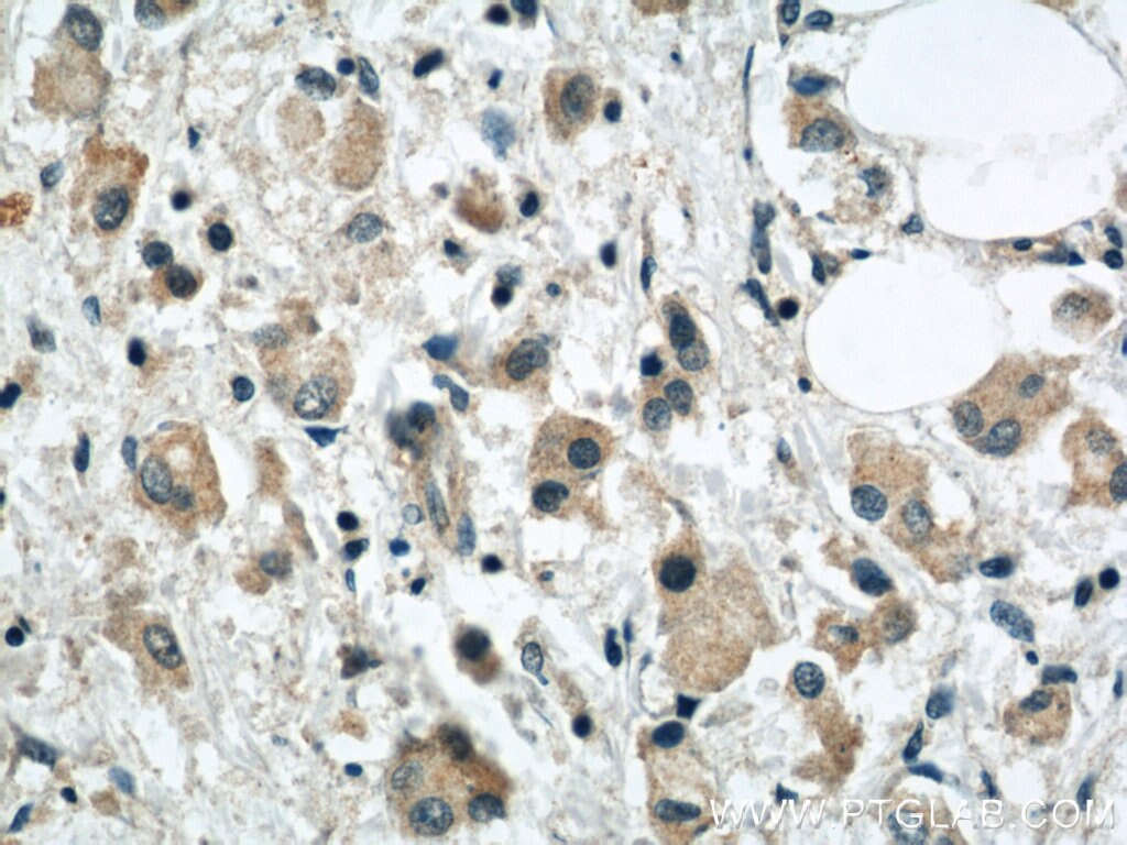 SYTL2 Polyclonal antibody