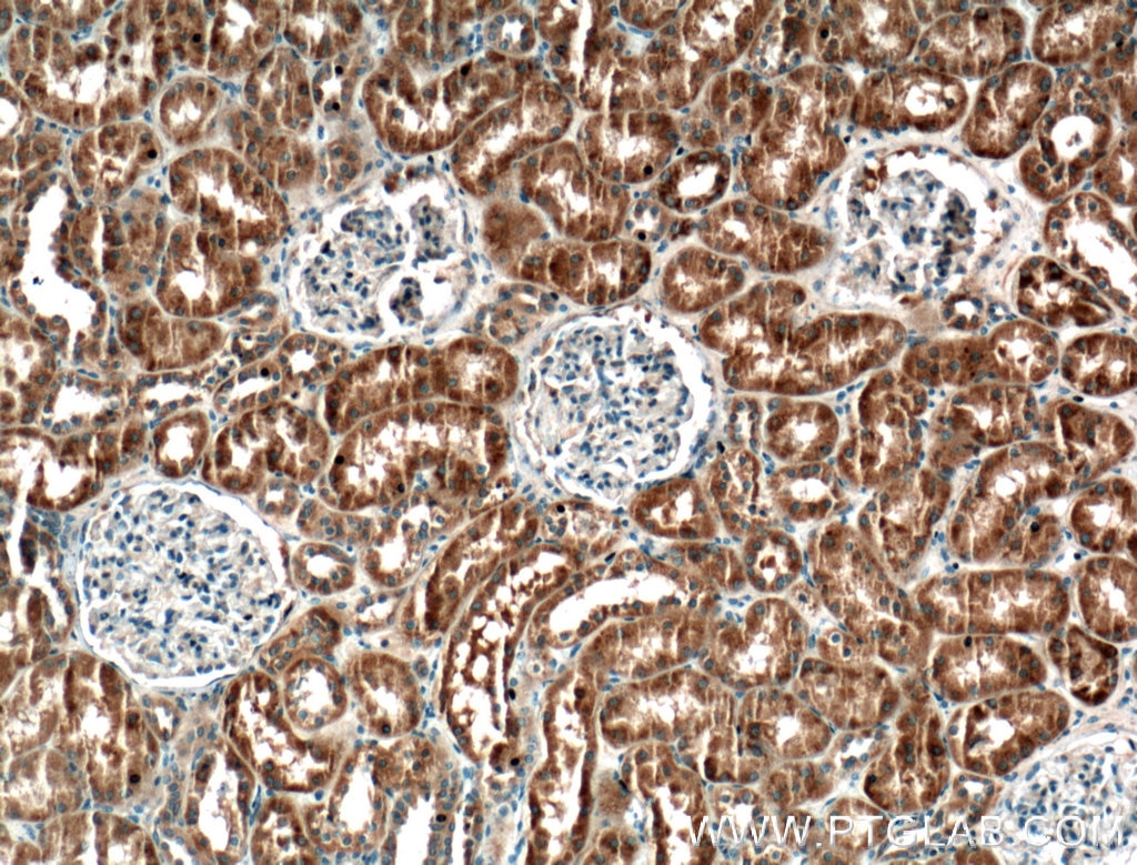 Immunohistochemistry (IHC) staining of human kidney tissue using SYTL3 Polyclonal antibody (22076-1-AP)