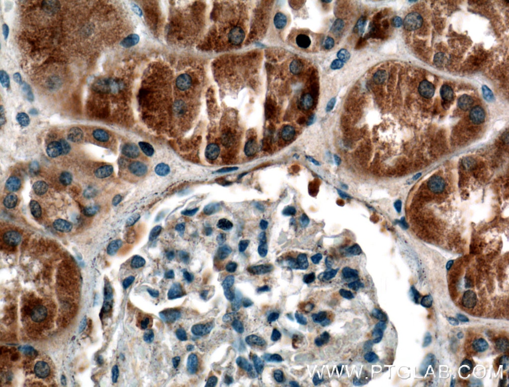 Immunohistochemistry (IHC) staining of human kidney tissue using SYTL3 Polyclonal antibody (22076-1-AP)