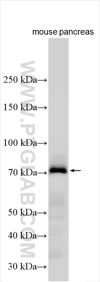 Western Blot (WB) analysis of mouse pancreas tissue using SYTL4 Polyclonal antibody (12128-1-AP)