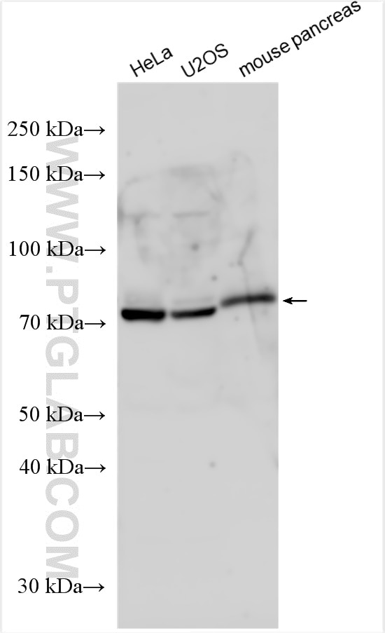 Western Blot (WB) analysis of various lysates using SYTL4 Polyclonal antibody (12128-1-AP)