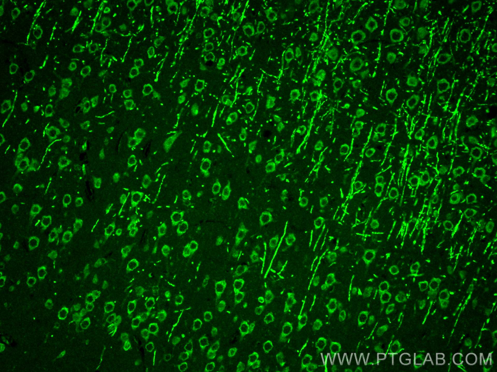 Immunofluorescence (IF) / fluorescent staining of rat brain tissue using SYTL5 Polyclonal antibody (24528-1-AP)