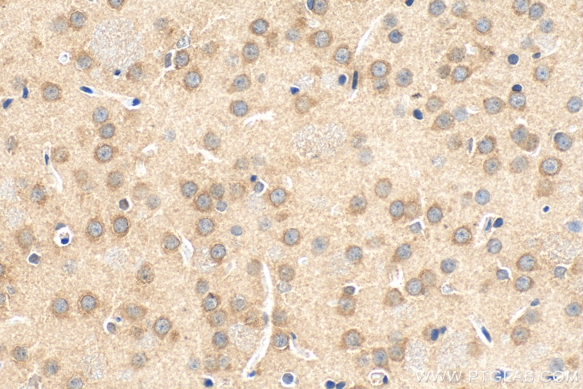 Immunohistochemistry (IHC) staining of rat brain tissue using SYTL5 Polyclonal antibody (24528-1-AP)