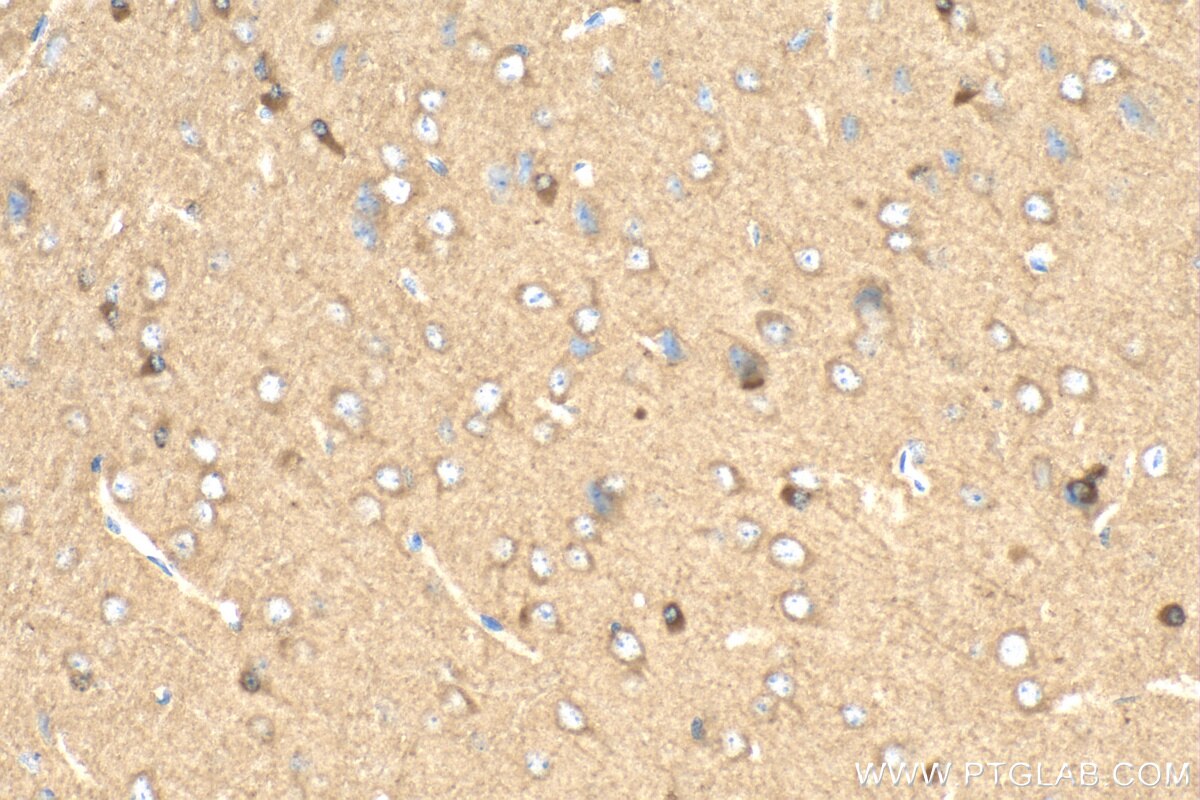 Immunohistochemistry (IHC) staining of mouse brain tissue using SYTL5 Polyclonal antibody (24528-1-AP)