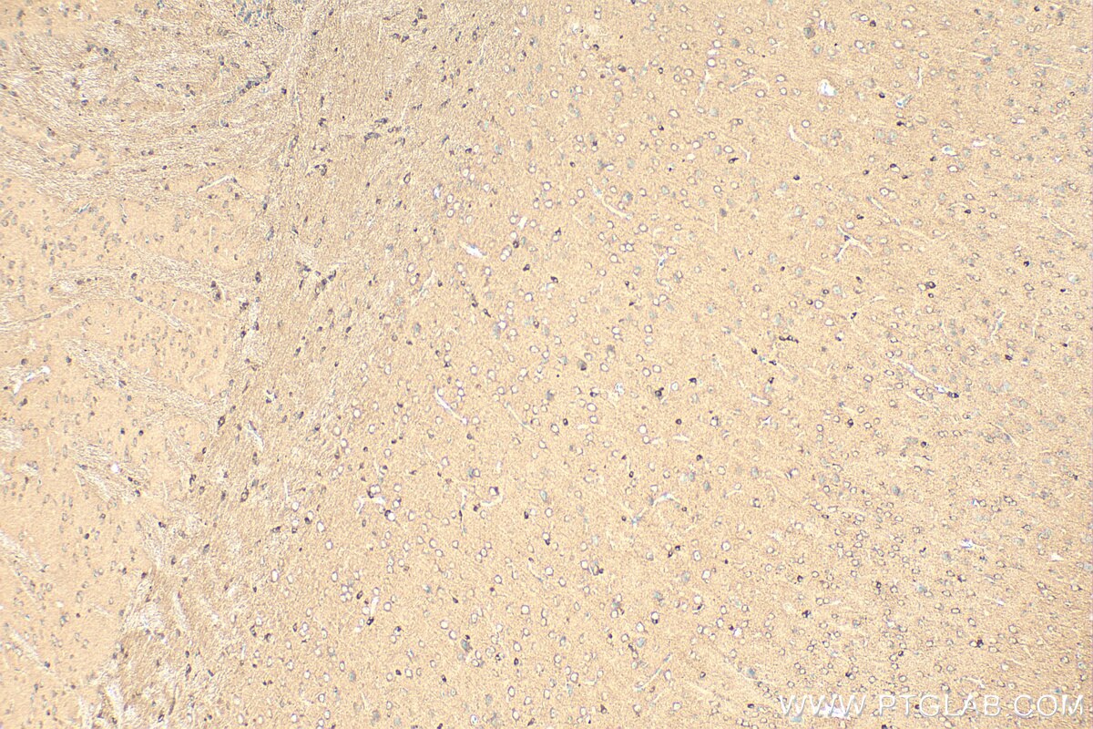 Immunohistochemistry (IHC) staining of mouse brain tissue using SYTL5 Polyclonal antibody (24528-1-AP)