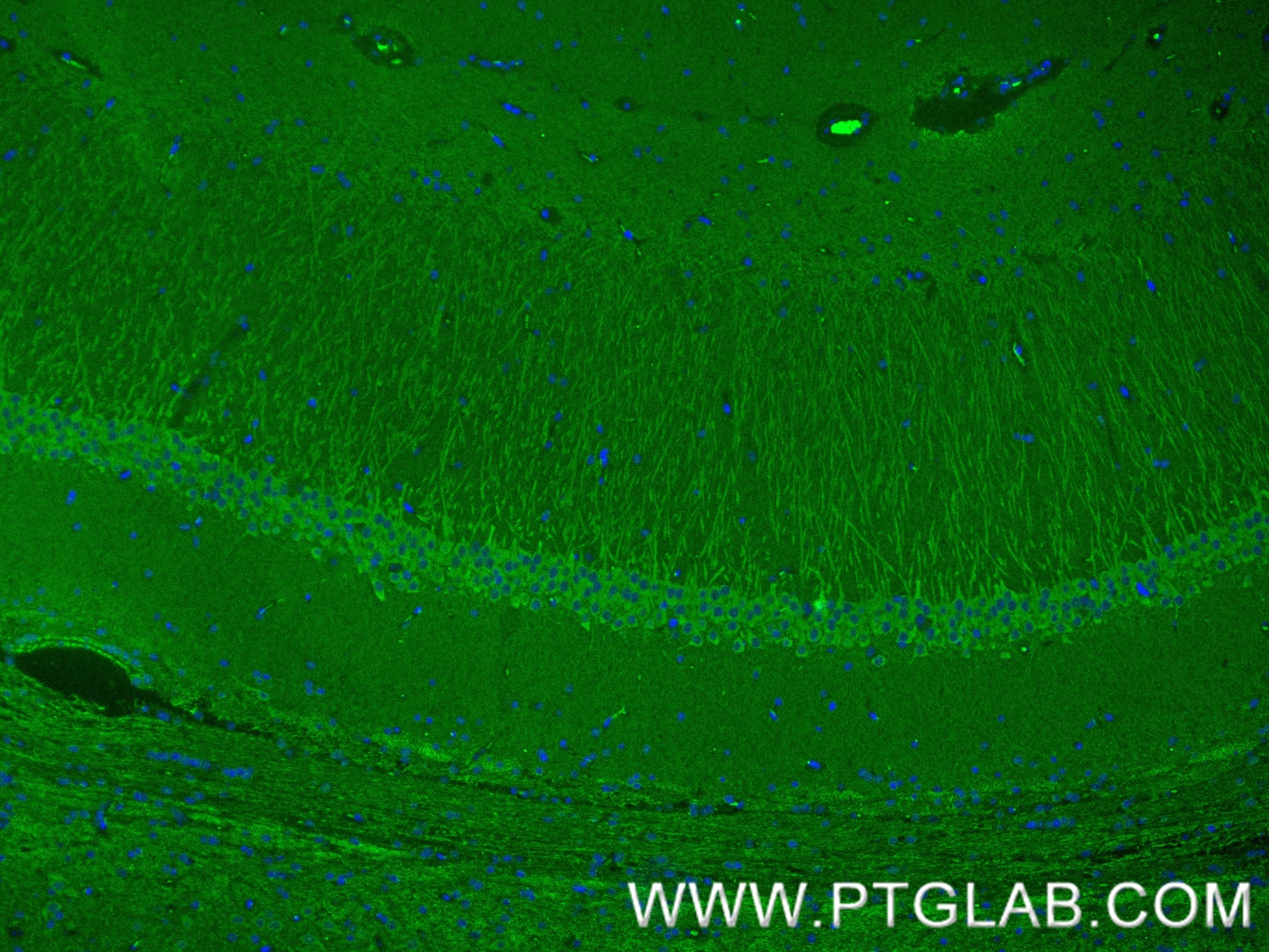 Immunofluorescence (IF) / fluorescent staining of rat brain tissue using SYTL5 Recombinant antibody (85108-5-RR)