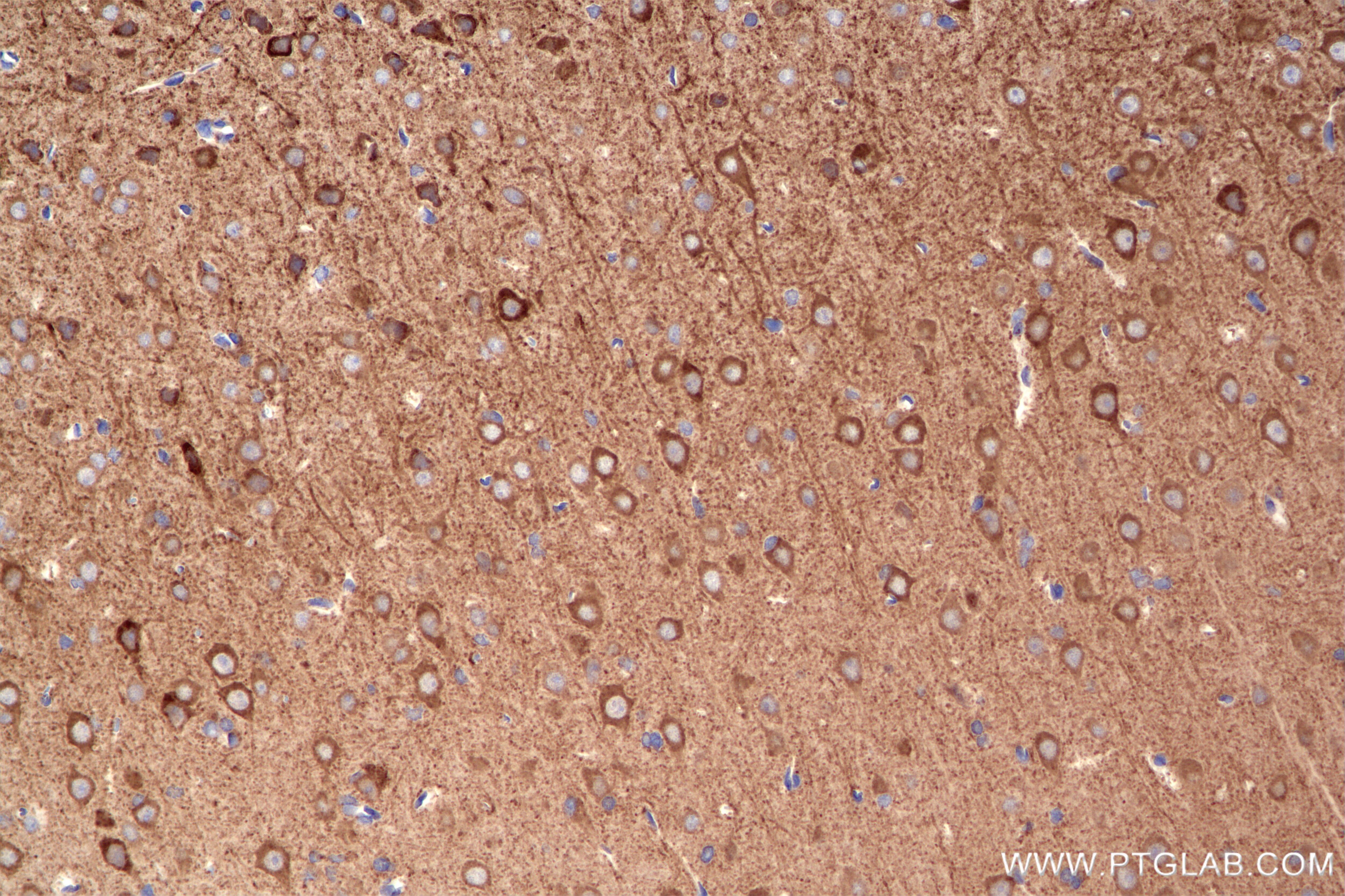 Immunohistochemistry (IHC) staining of rat brain tissue using SYTL5 Recombinant monoclonal antibody (85108-5-RR)