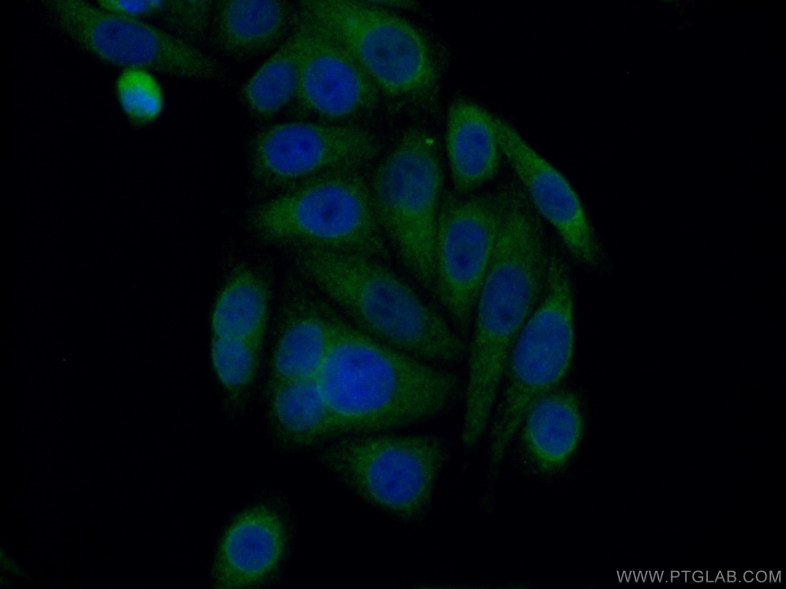 Immunofluorescence (IF) / fluorescent staining of HepG2 cells using HRD1/SYVN1 Polyclonal antibody (13473-1-AP)
