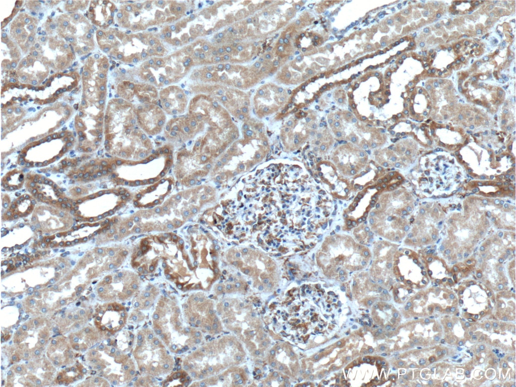 Immunohistochemistry (IHC) staining of human kidney tissue using HRD1/SYVN1 Polyclonal antibody (13473-1-AP)