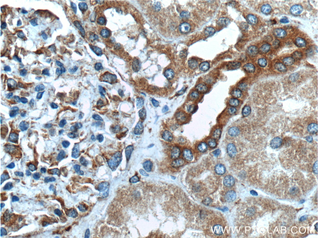 Immunohistochemistry (IHC) staining of human kidney tissue using HRD1/SYVN1 Polyclonal antibody (13473-1-AP)