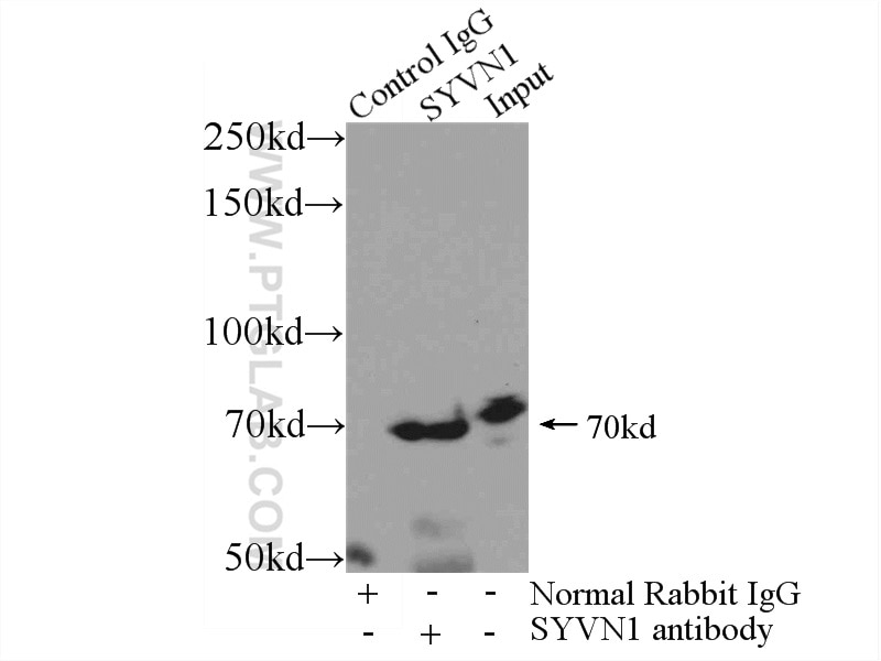 Immunoprecipitation (IP) experiment of mouse kidney tissue using HRD1/SYVN1 Polyclonal antibody (13473-1-AP)