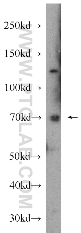 Western Blot (WB) analysis of rat stomach tissue using HRD1/SYVN1 Polyclonal antibody (13473-1-AP)