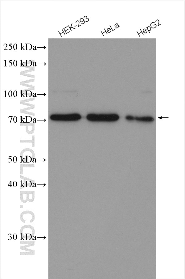 Western Blot (WB) analysis of various lysates using HRD1/SYVN1 Polyclonal antibody (13473-1-AP)