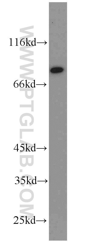 WB analysis of mouse stomach using 13473-1-AP