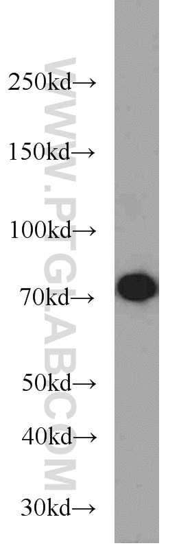 Western Blot (WB) analysis of HepG2 cells using HRD1/SYVN1 Polyclonal antibody (13473-1-AP)