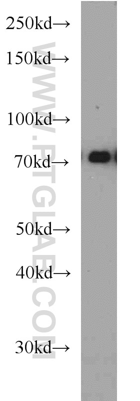 HRD1/SYVN1 Polyclonal antibody