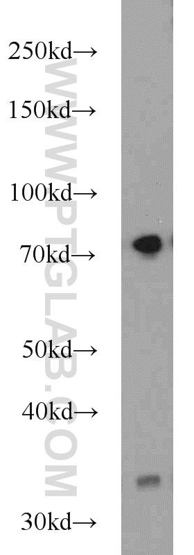 Western Blot (WB) analysis of NIH/3T3 cells using HRD1/SYVN1 Polyclonal antibody (13473-1-AP)