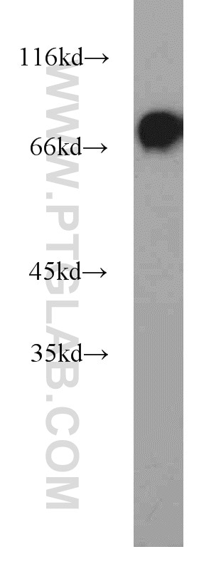 Western Blot (WB) analysis of Raji cells using HRD1/SYVN1 Polyclonal antibody (13473-1-AP)